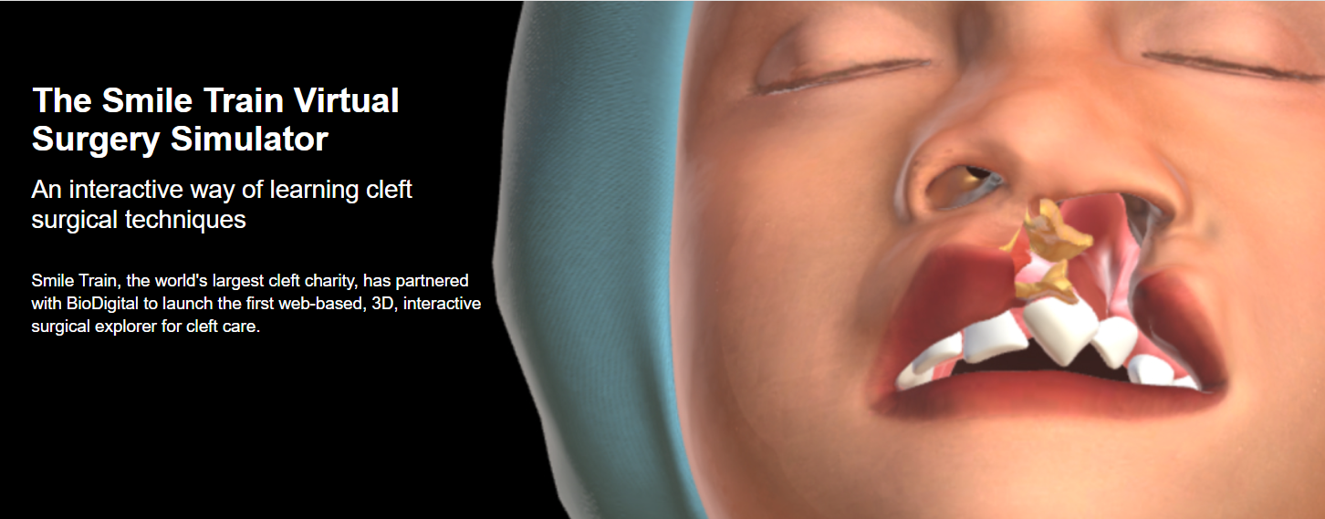 Metaverse Operating Room Simulates Surgery on Cleft Lip & Palate