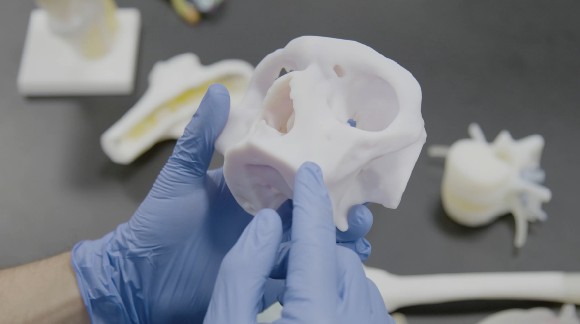 Stratasys, Ricoh Partner to Provide On-Demand 3D-Printed Anatomic Models for Hospitals and Clinics