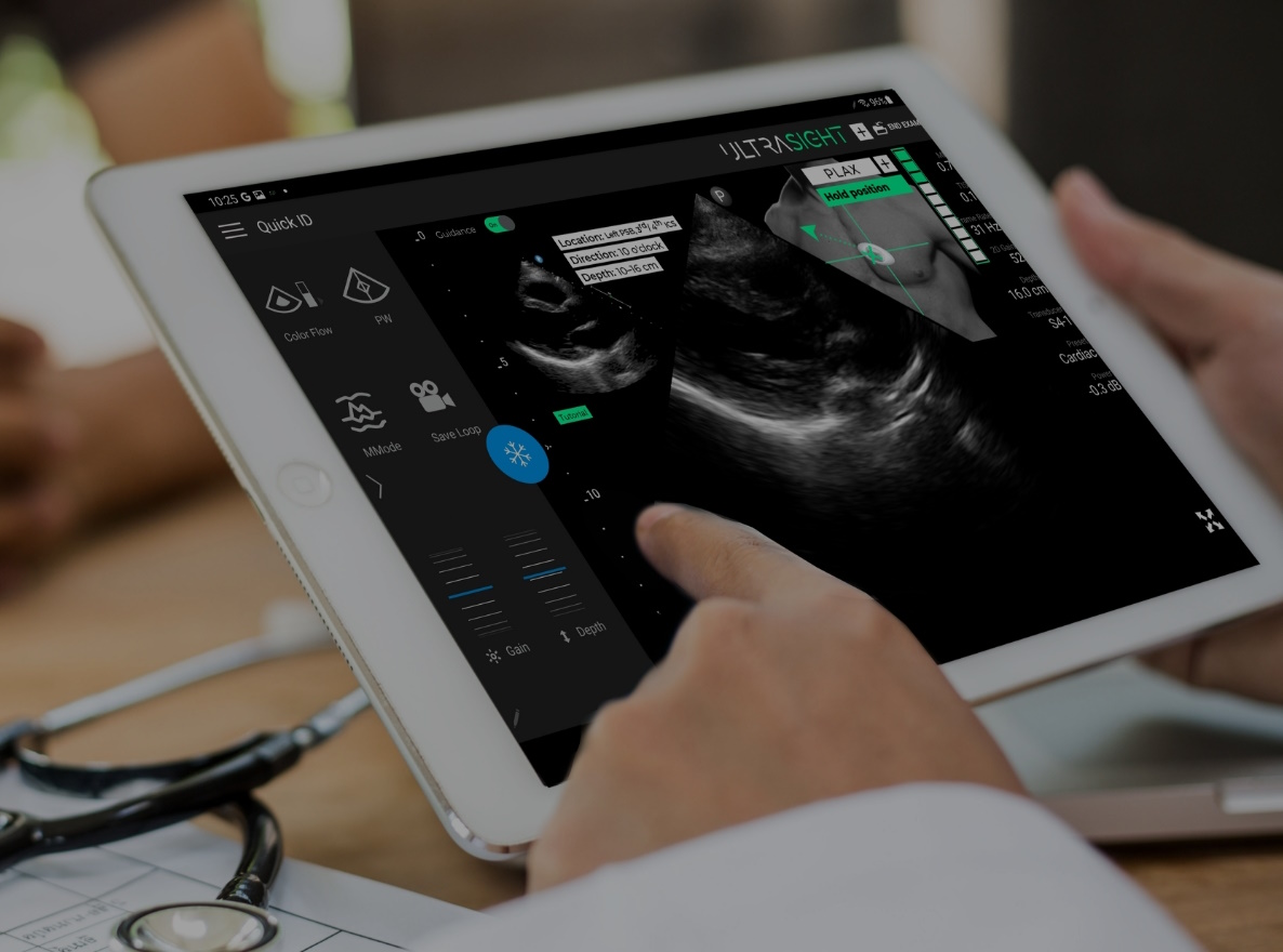 FDA Grants Clearance for UltraSight's AI Cardiac Ultrasound