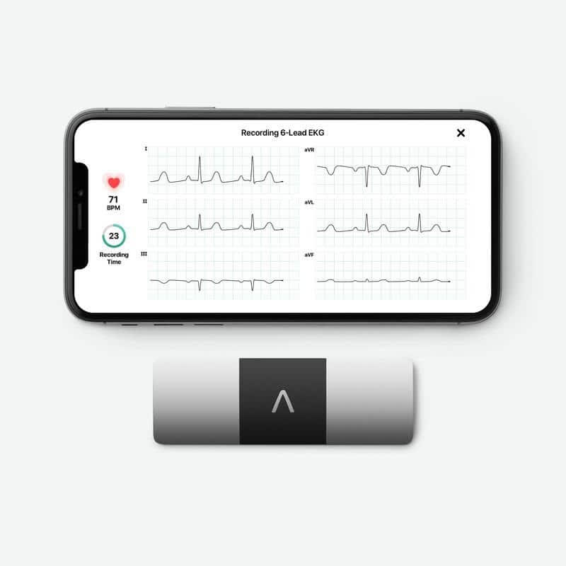 AliveCor and Clario Partner to Offer Decentralized Clinical Trials- Focused Six-Lead ECG Solutions 