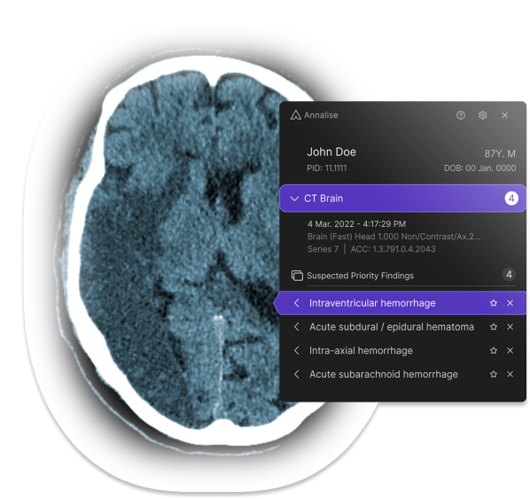 Annalise.ai Receives FDA Clearance for Radiology Triage Device