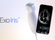Exo Unveils Handheld Ultrasound Device