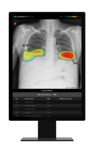 Lunit and NTT DATA Partner to Deploy AI-Powered Chest X-ray Solution in Singapore