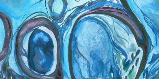 Owkin, Proscia Partner to Streamline MSI Testing for Colorectal Cancer