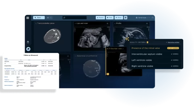 Sonio Launches AI-Powered Voice Recognition for Ultrasound Reporting