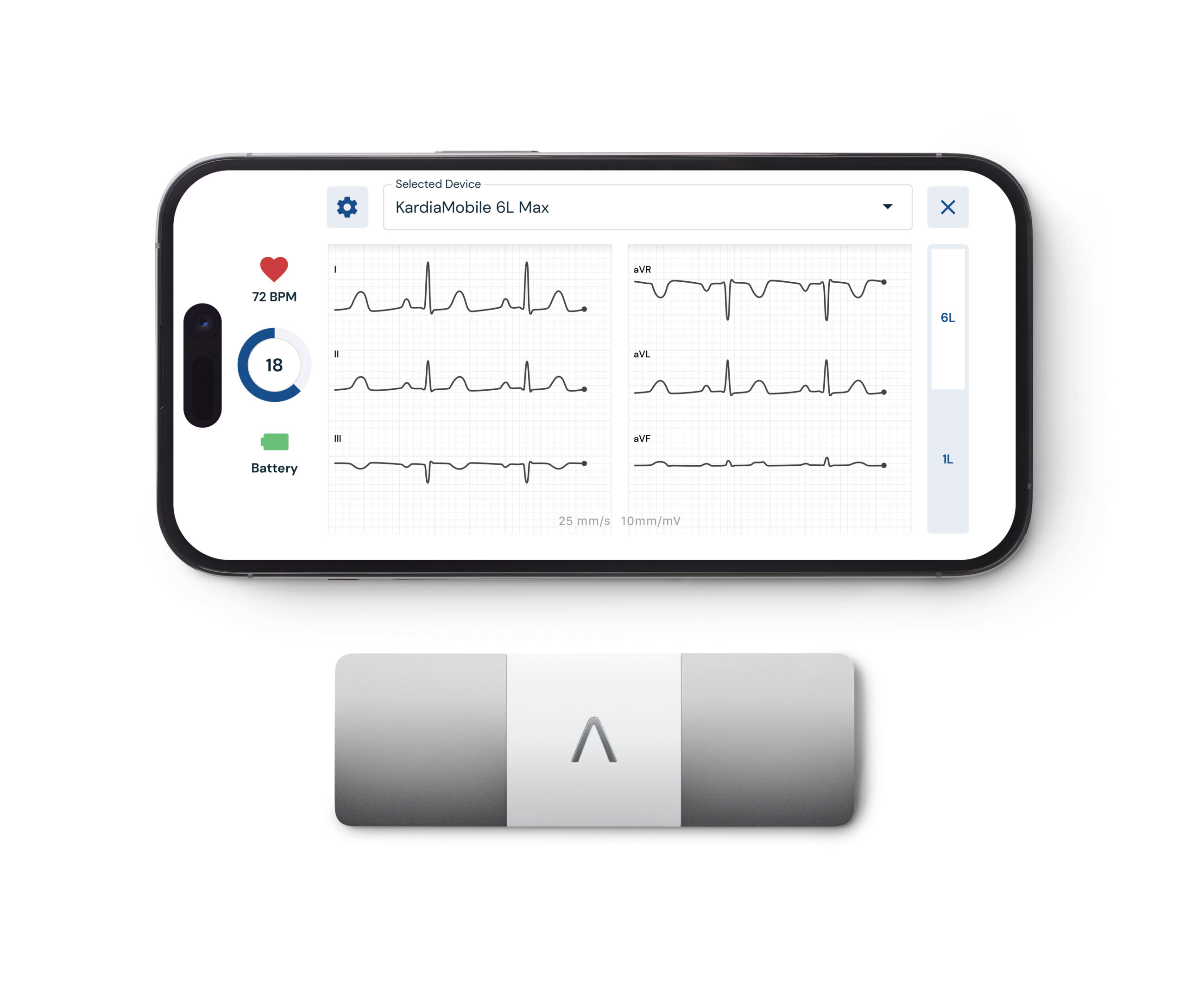 ​​AliveCor Unveils KardiaMobile 6L Max & KardiaAlert for Advanced Personal ECG Monitoring