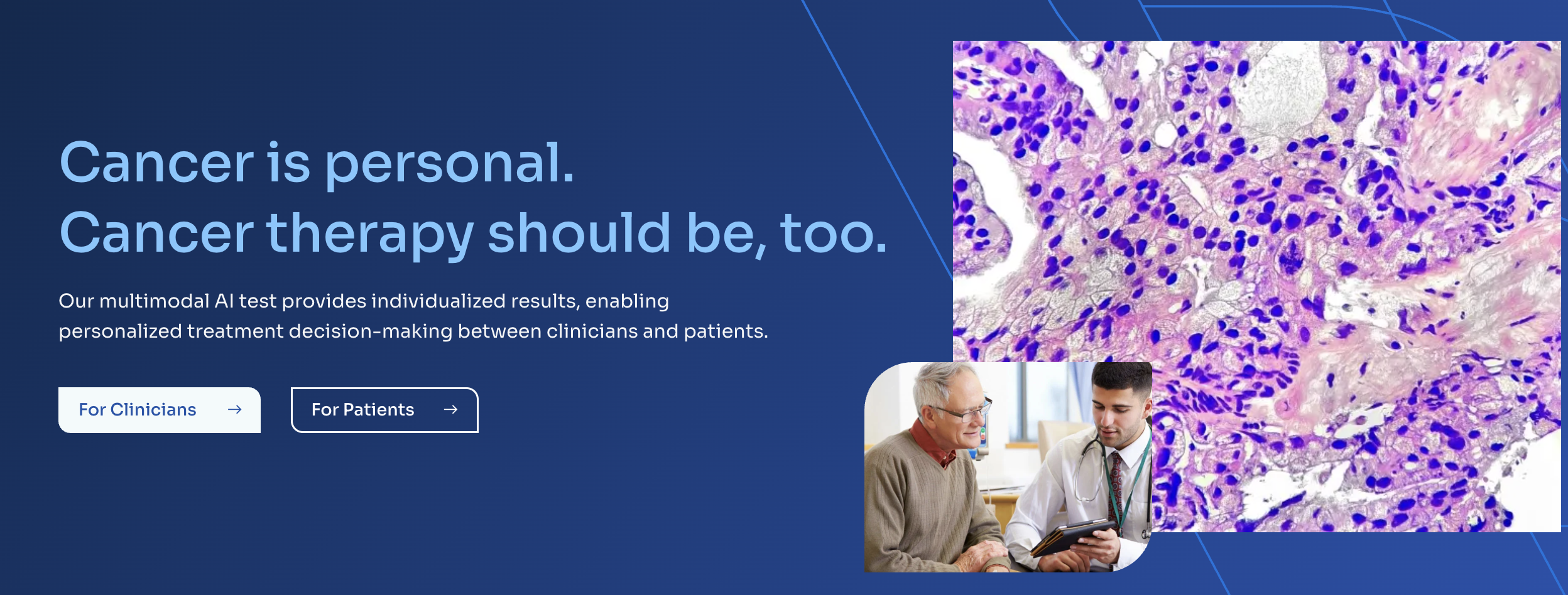 AI Study Challenges Fears of Racial Bias in Prostate Cancer Care