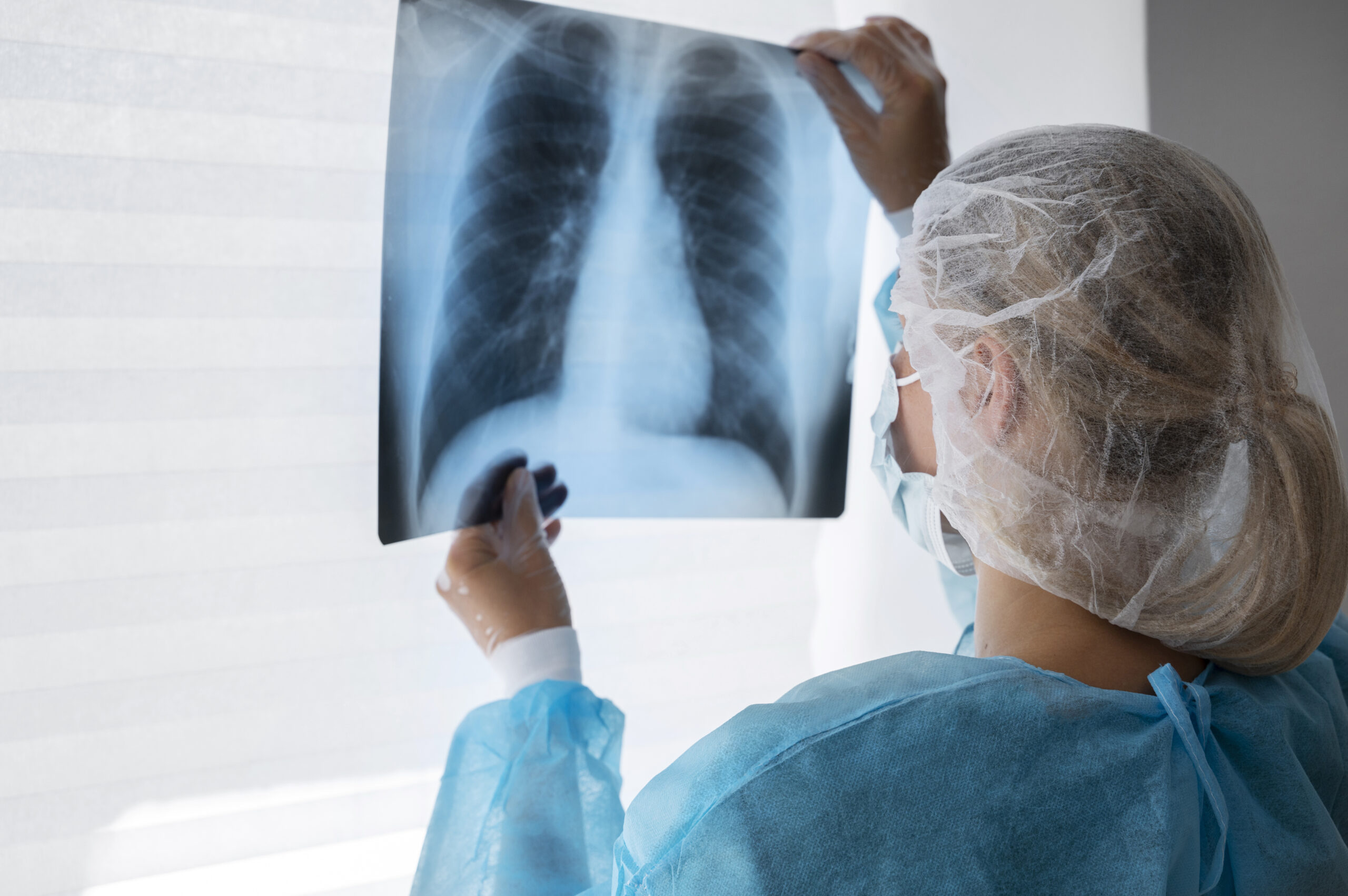 Latest Advances in Stage 4 Lung Cancer Treatment: What Patients Need to Know