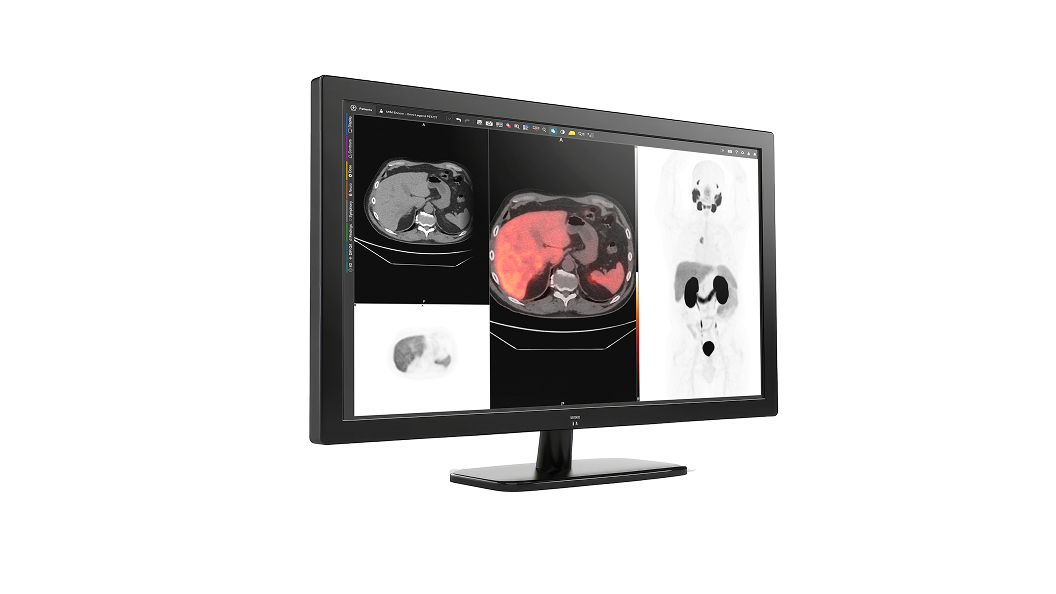 GE HealthCare Integrates Advanced Features with MIM Encore Platform