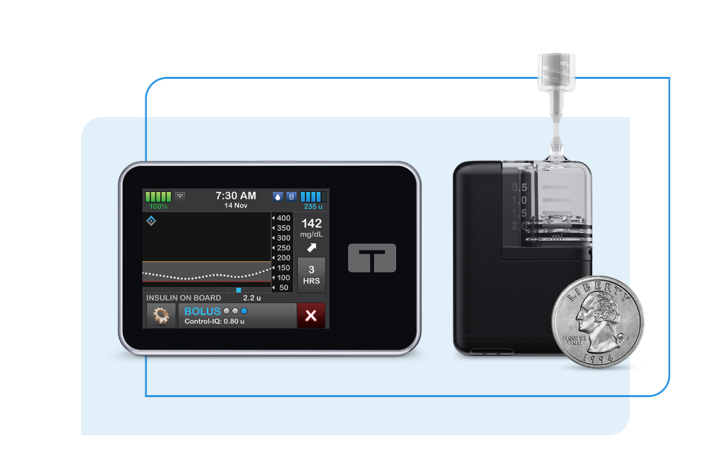 Tandem’s t:slim X2 Insulin Pump Now Integrates with Abbott’s FreeStyle Libre 3 Plus Sensor