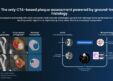 UnitedHealthcare to Cover Elucid’s PlaqueIQ CTA Plaque Analysis Starting 10/1