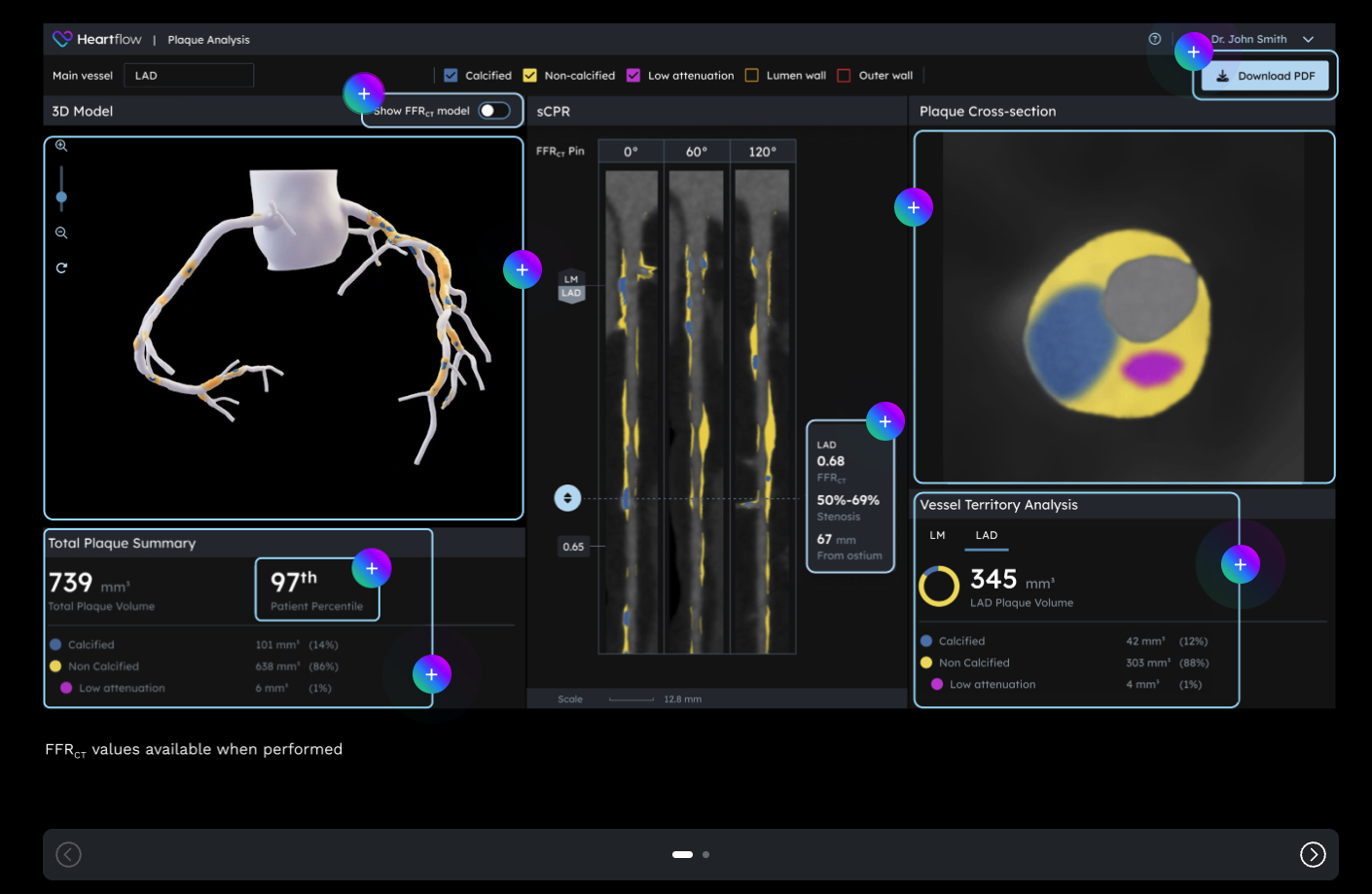 Heartflow Receives FDA Clearance for Next-Gen AI Plaque Analysis, Expands Cigna Coverage