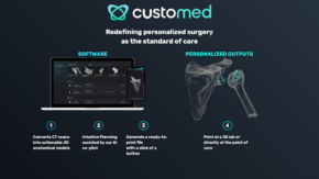 CustoMED Secures $6M to Scale AI-Driven, Patient-Specific Orthopedic Surgery