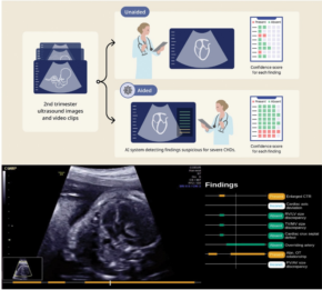 Mount Sinai Pioneers AI-Enhanced Fetal Ultrasounds, Achieves Near-Perfect Detection Rates for Congenital Heart Defects