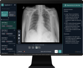 How Horizon Health and Qure.ai Are Using AI to Catch "Incidental" Lung Cancer