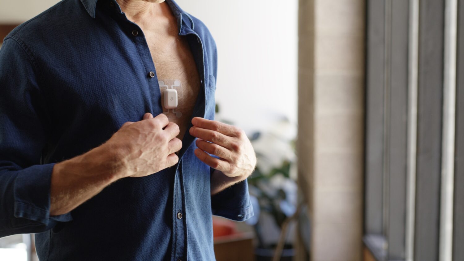 Why Cardiologists Are Betting $19M on Wearlinq to Fix the "Single-Lead" Problem in Heart Monitoring