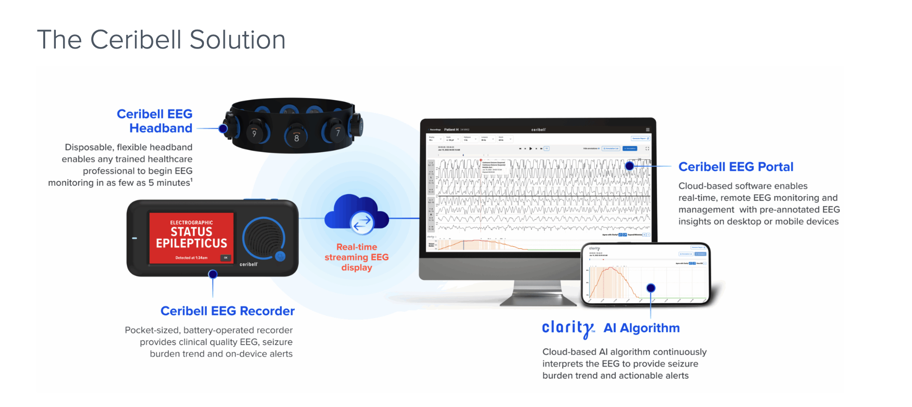 The EEG as a &lsquo;Vital Sign&rsquo;: Ceribell&rsquo;s AI Pivot to In-Hospital Stroke Detection