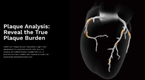 The Standard of Care Shift: Heartflow Secures Nationwide Aetna Coverage for AI Plaque Analysis