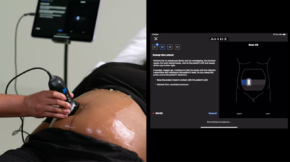 Butterfly Network Receives FDA Clearance for AI-Powered Gestational Age Ultrasound Tool