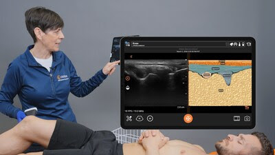 Clarius Mobile Health Launches T-Mode Heart and Knee for AI-Powered Ultrasound Training