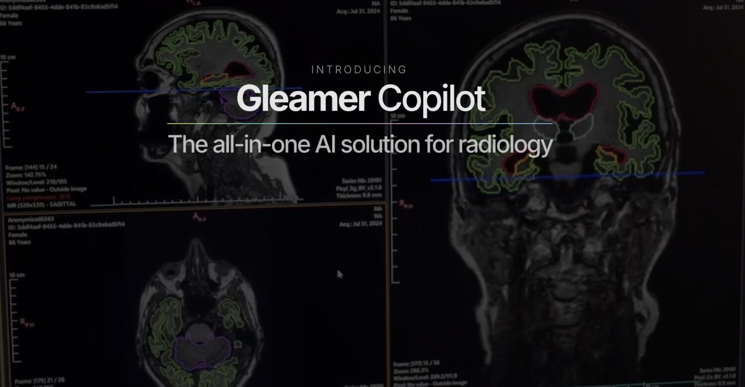 RadNet Subsidiary DeepHealth Acquires French Radiology AI Leader Gleamer