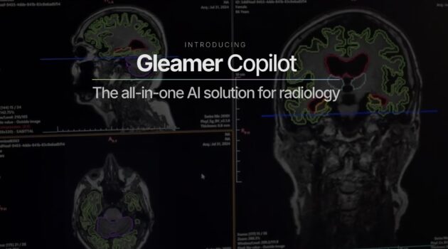 RadNet Subsidiary DeepHealth Acquires French Radiology AI Leader Gleamer