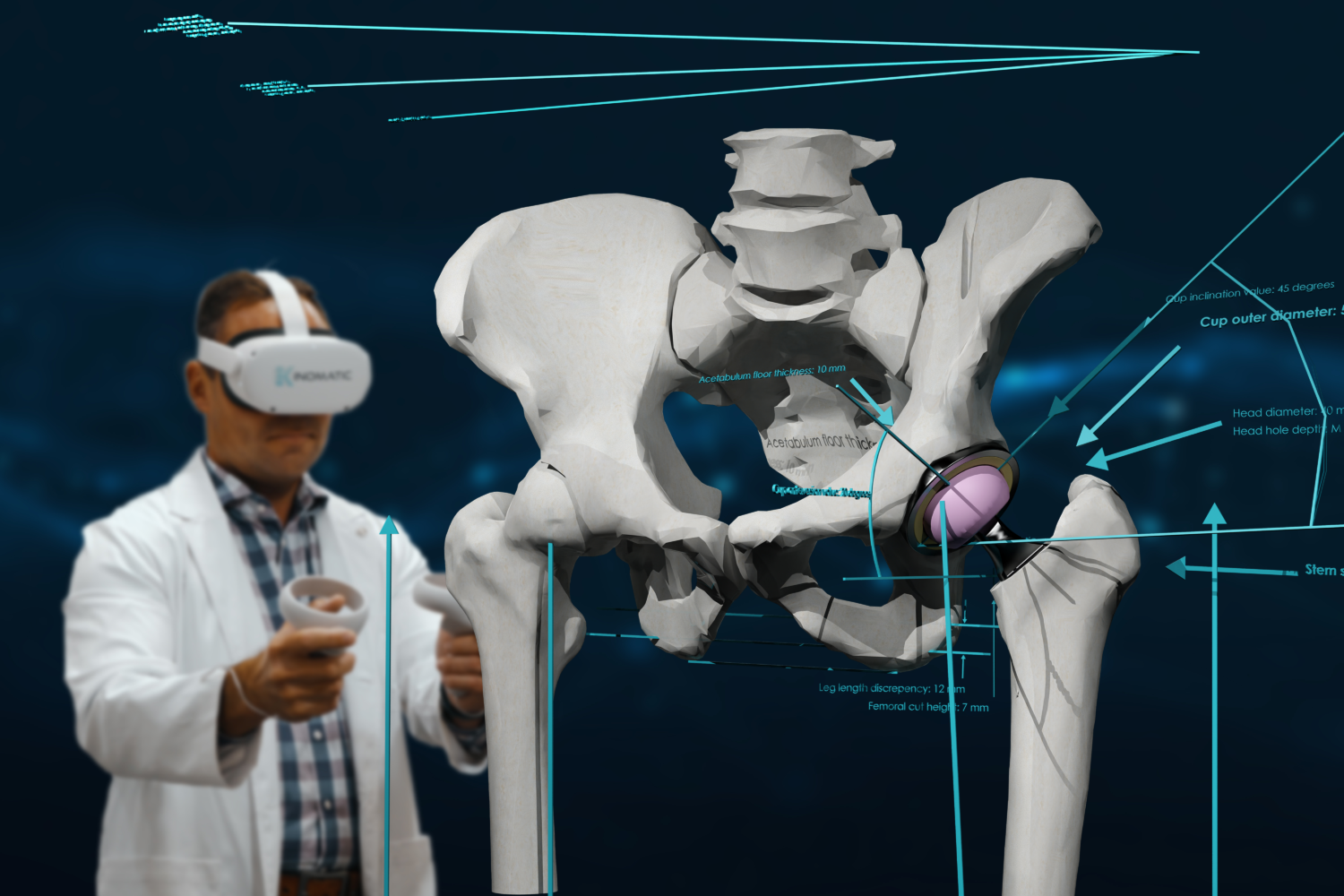 Kinomatic Secures $4M to Expand&nbsp; AI-Enabled Surgical Planning Platform