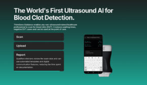 ThinkSono Receives FDA 510(k) Clearance for First AI-Powered DVT Ultrasound Software