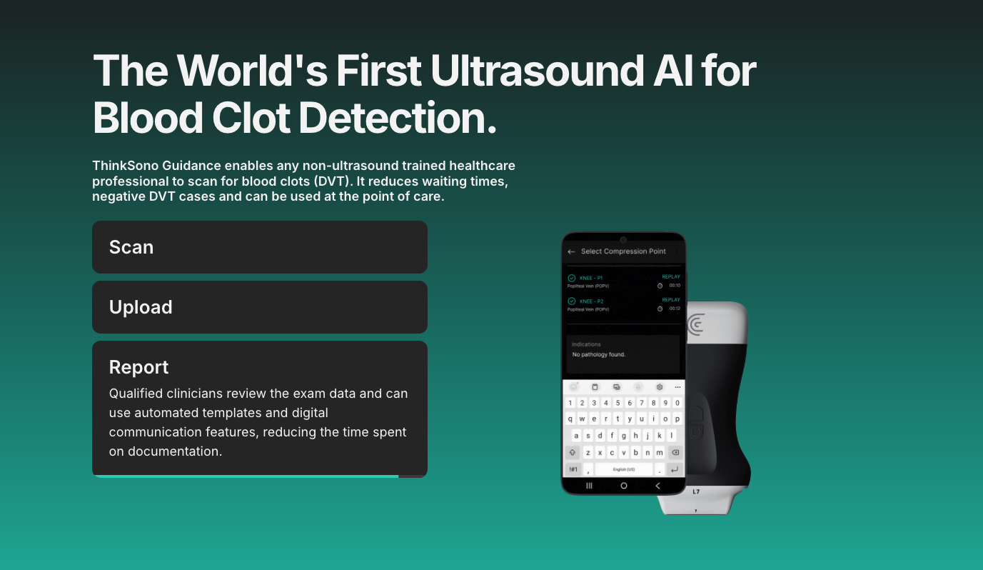 ThinkSono Receives FDA 510(k) Clearance for First AI-Powered DVT Ultrasound Software