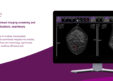 DeepHealth Receives FDA 510(k) Clearance for AI-Driven Breast Ultrasound Automation