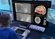 Philips Wins $33.7M ARPA-H Award to Scale Autonomous Robotic Thrombectomy