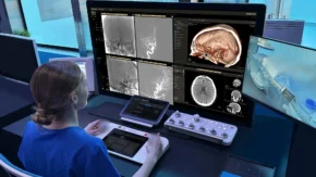 Philips Wins $33.7M ARPA-H Award to Scale Autonomous Robotic Thrombectomy