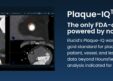 Elucid Raises $55M to Expand Non-Invasive Cardiovascular Diagnostic Platform