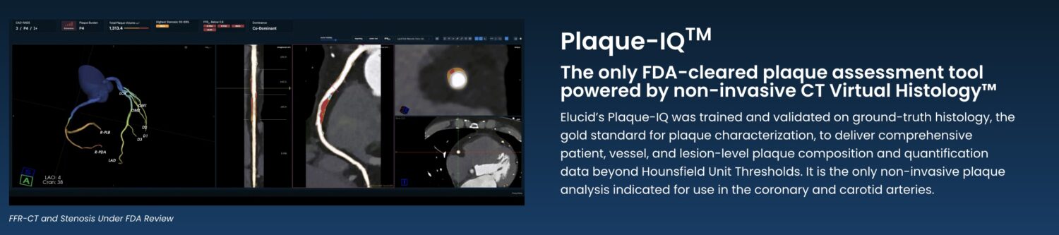 Elucid Raises $55M to Expand Non-Invasive Cardiovascular Diagnostic Platform