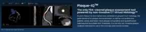 Elucid Raises $55M to Expand Non-Invasive Cardiovascular Diagnostic Platform