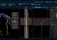 Elucid Scores FDA Clearance for FFR-IQ to Unify Plaque Biology and Hemodynamics