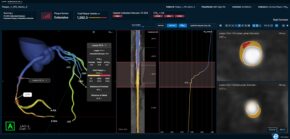 Elucid Scores FDA Clearance for FFR-IQ to Unify Plaque Biology and Hemodynamics