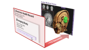 Avatar Medical Launches Epic EHR Integration for Real-Time 3D Surgical Planning and Patient Consultations