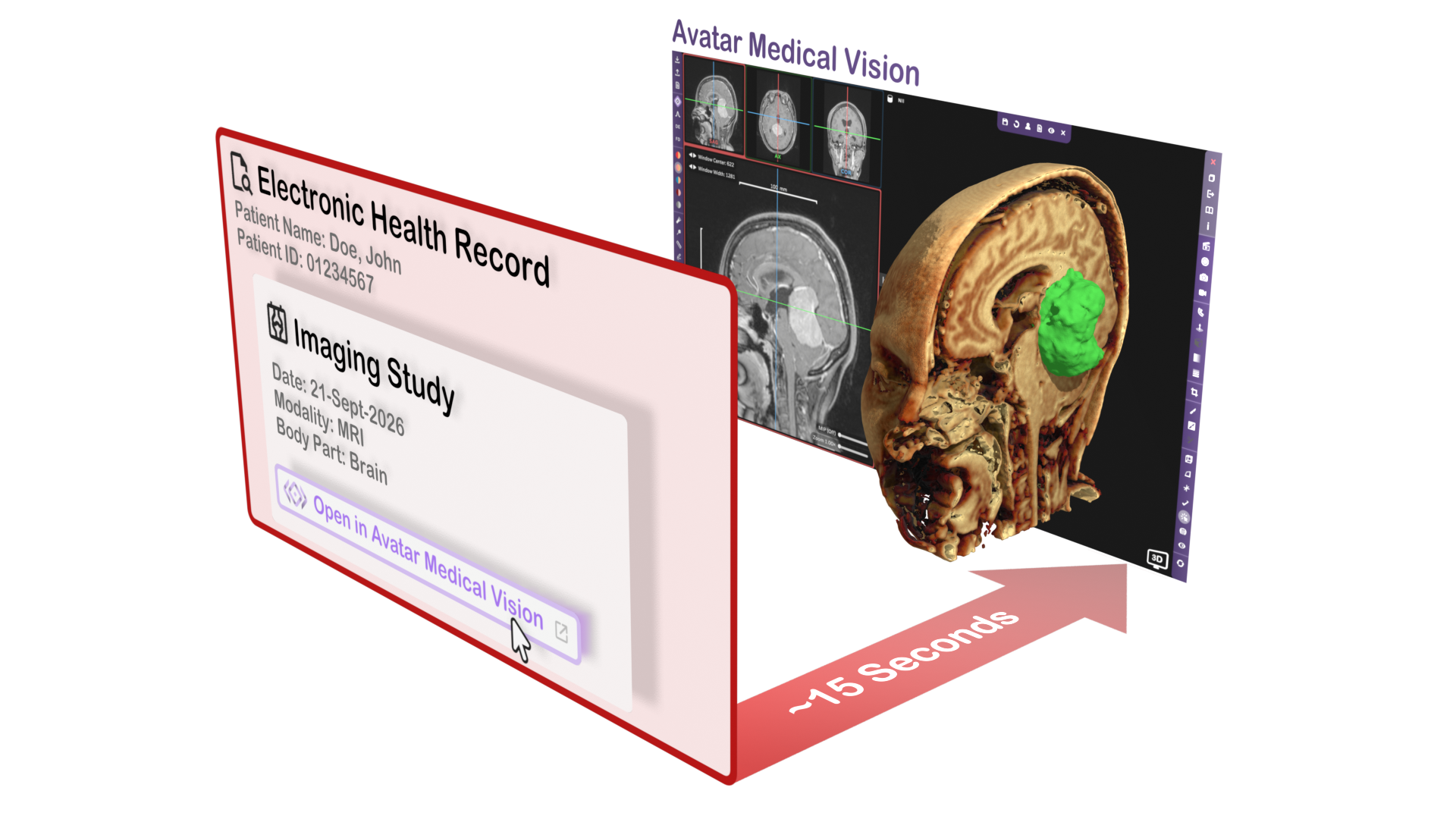Avatar Medical Launches Epic EHR Integration for Real-Time 3D Surgical Planning and Patient Consultations